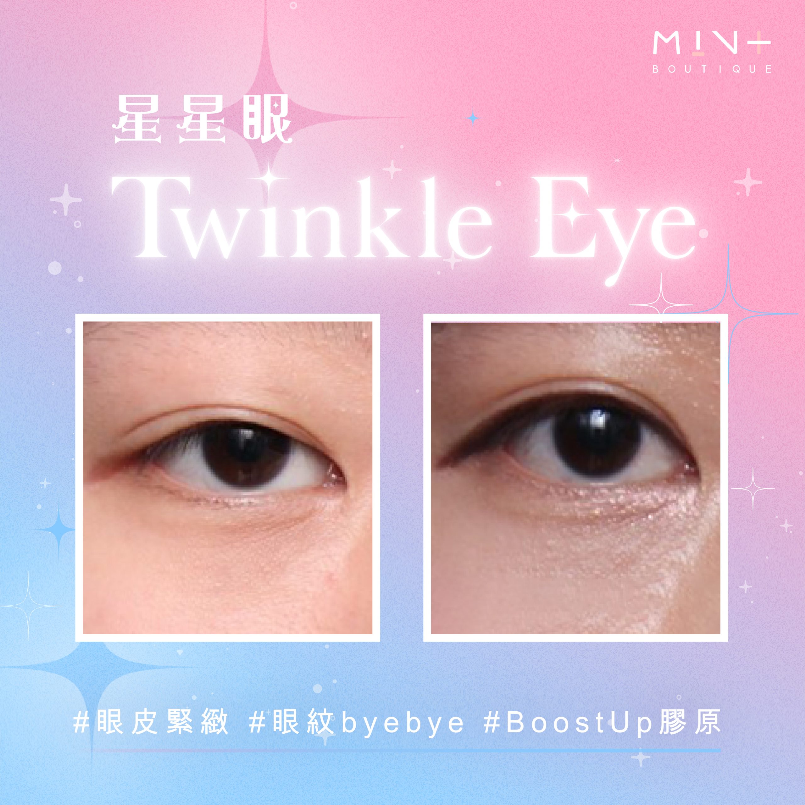 twinkle eye banner_twinkle eye BA-01 copy