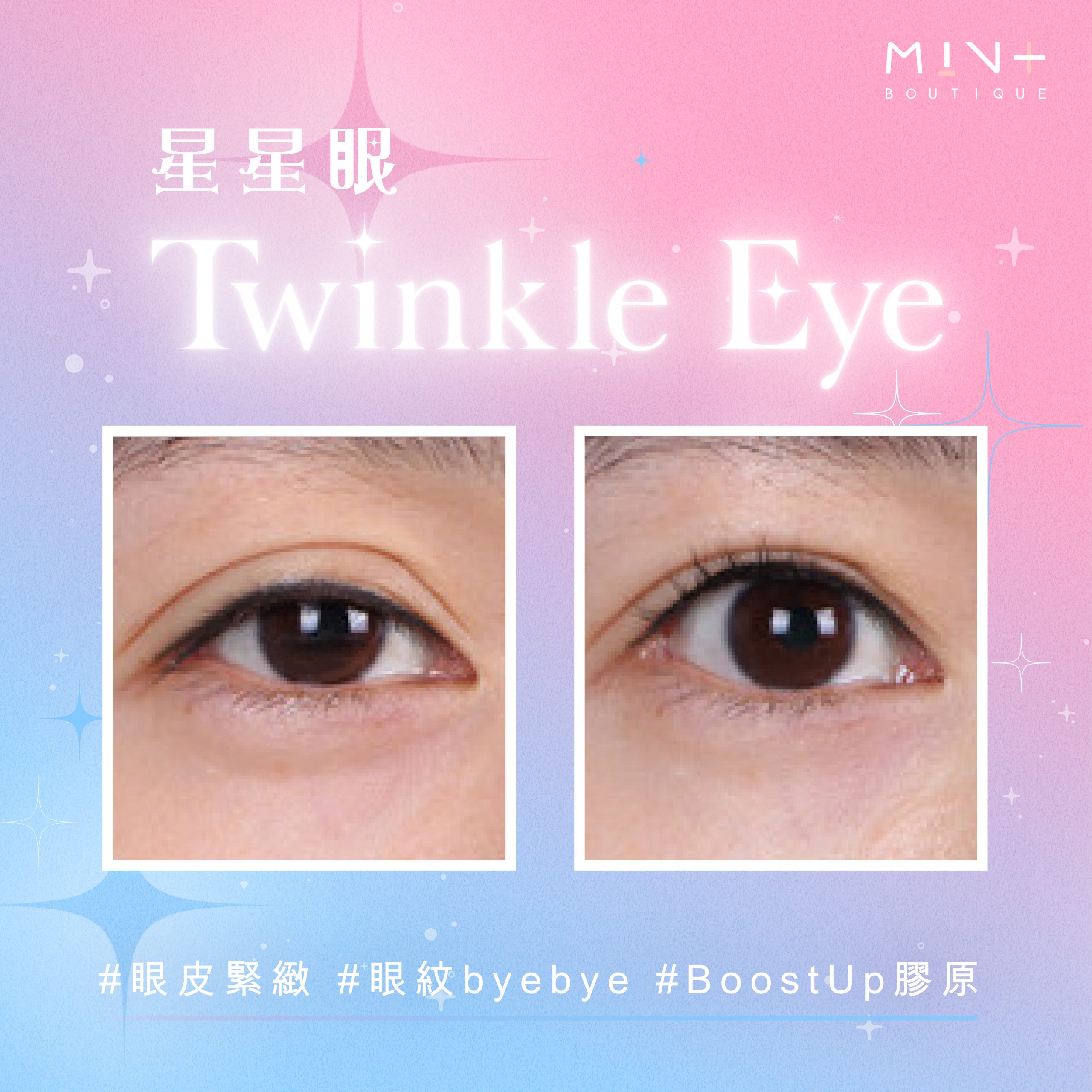 twinkle eye banner_twinkle eye BA-01